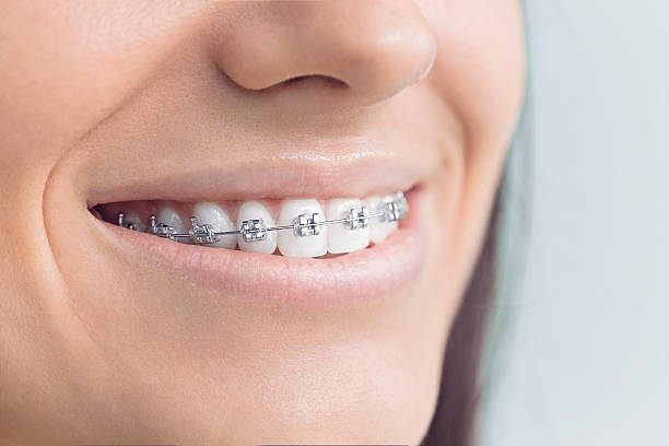 Best Teeth Whitening  in Roseland, OH